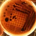Во „БИОМЕД ЛАБ“ се врши испитување на Staphylococcus spp. кај мажи