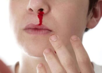 Во БИОМЕД ЛАБ се врши детекција на генетските промени поврзани со Фон Вилебрандова болест